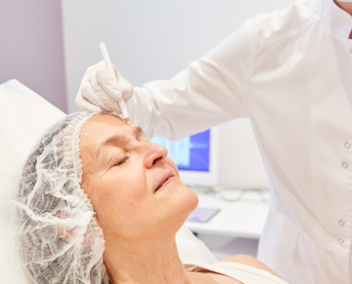 procedura del lifting viso chirurgico