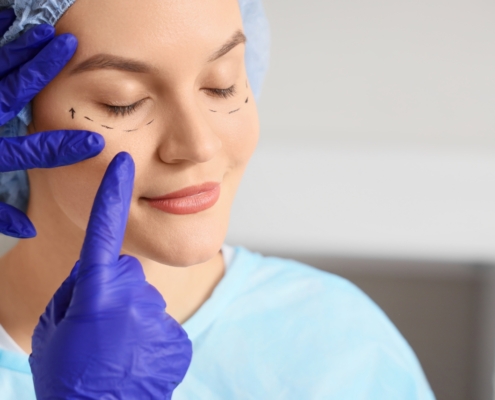 Fattori che influenzano i risultati, vantaggi e durata del lifting facciale